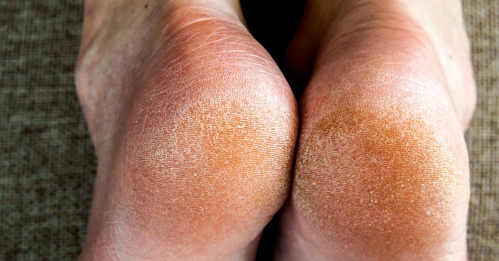 At-Home vs In-Clinic Foot Skin Care: What Works and What Doesn't