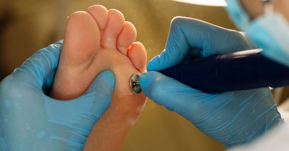 From Foot Assessment to Custom Plan: How to Enhance Movement and Prevent Injury
