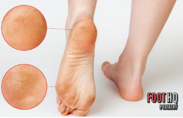 Can Walking Barefoot Around the House Cause Foot Problems?