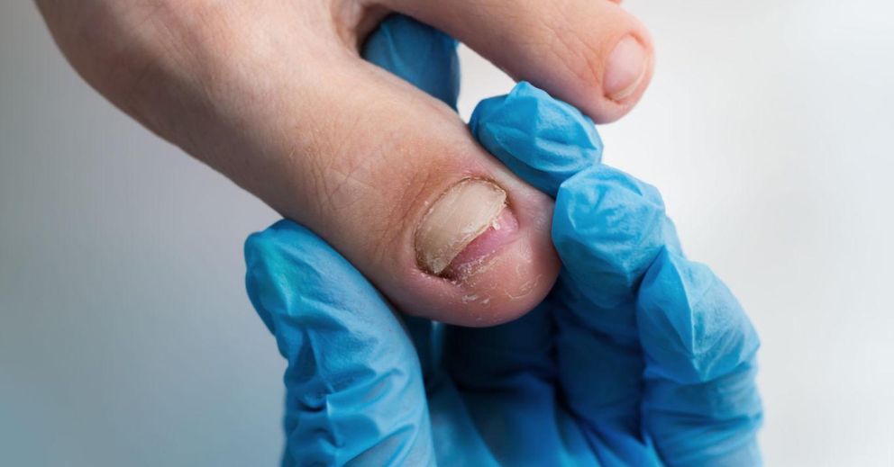 When to See a Podiatrist for a Painful Toenail