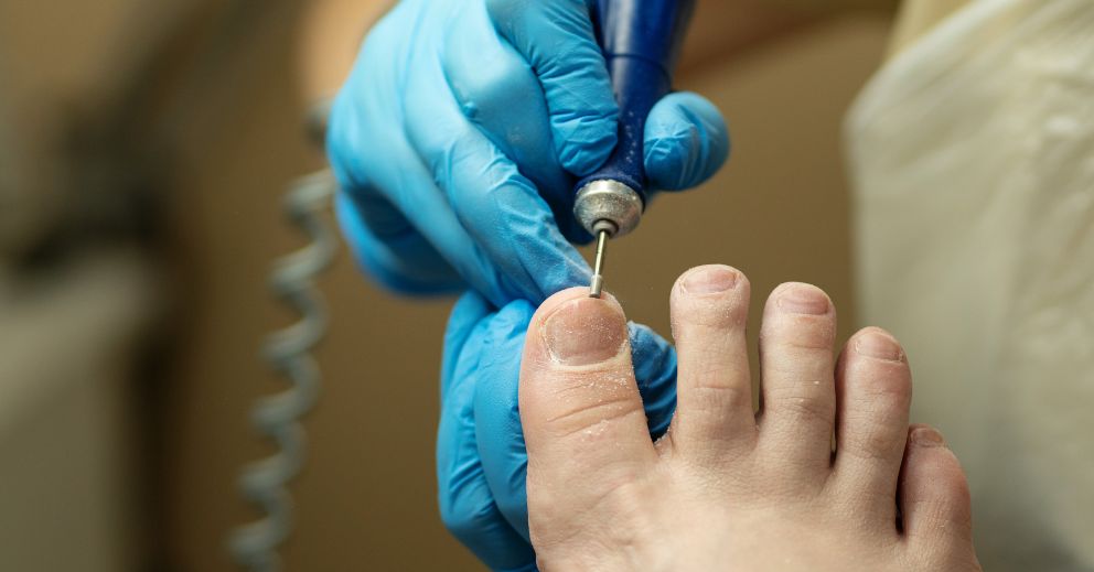Thickened Toenails, Cracked Heels & What Your Feet Are Trying to Tell You