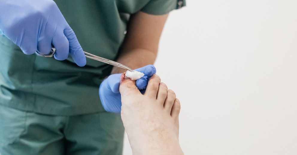 Preventing Ingrown Toenails: Footwear, Hygiene & When to See a Specialist
