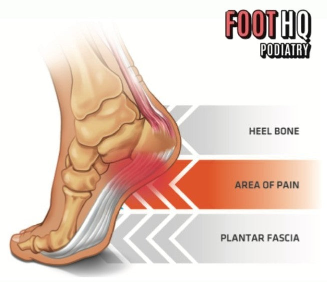 Why Do My Feet Hurt After Standing All Day?