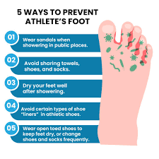 How Do I Treat and Prevent Athlete’s Foot or Foot Odour?