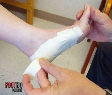 Can Foot Taping Help Relieve Plantar Fasciitis or Heel Pain?