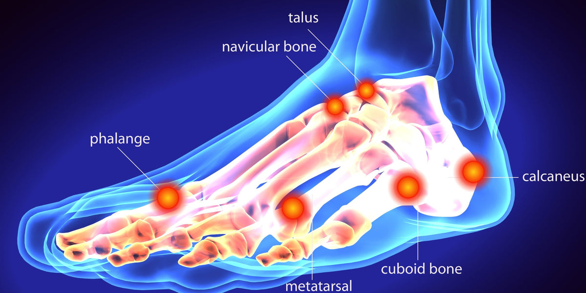 What is Foot Bursitis and How is it Treated? – Foot HQ Podiatry | Foot ...