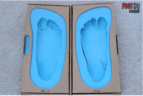 Are Custom Orthotics Worth It?